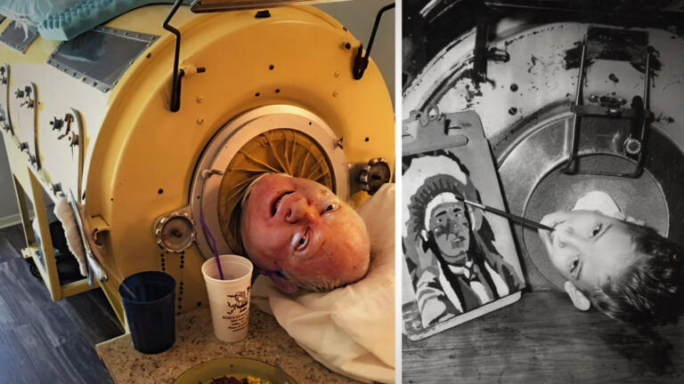 The Unstoppable Spirit of Paul Alexander: 70 Years in an Iron Lung