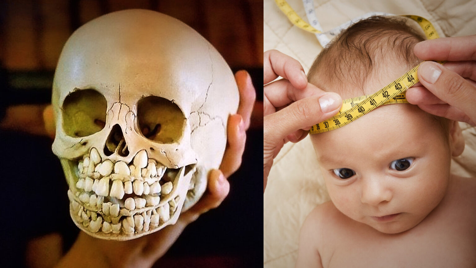 People terrified after seeing what a childs skull 000