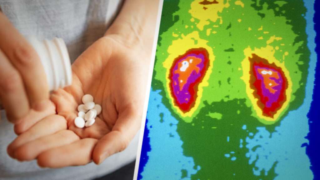 SERIOUS CONSEQUENCES TAKING 1176 IBUPROFEN TABLETS