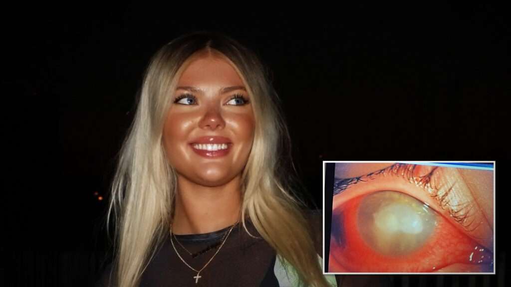 Woman goes blind after grain of sand