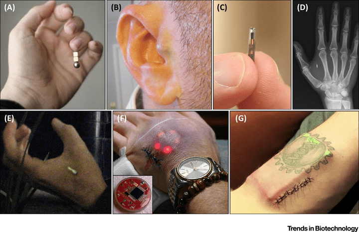 biohacking