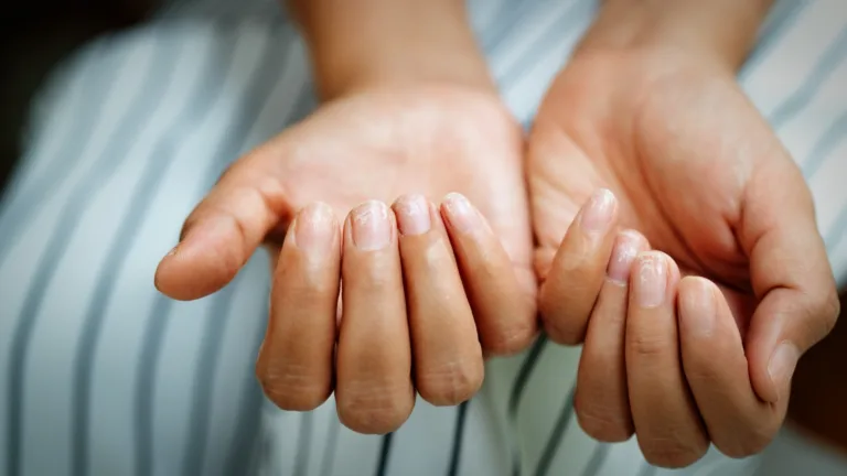 What Your Fingernails Say About Your Lifespan – A Doctor’s Warning You Can’t Ignore